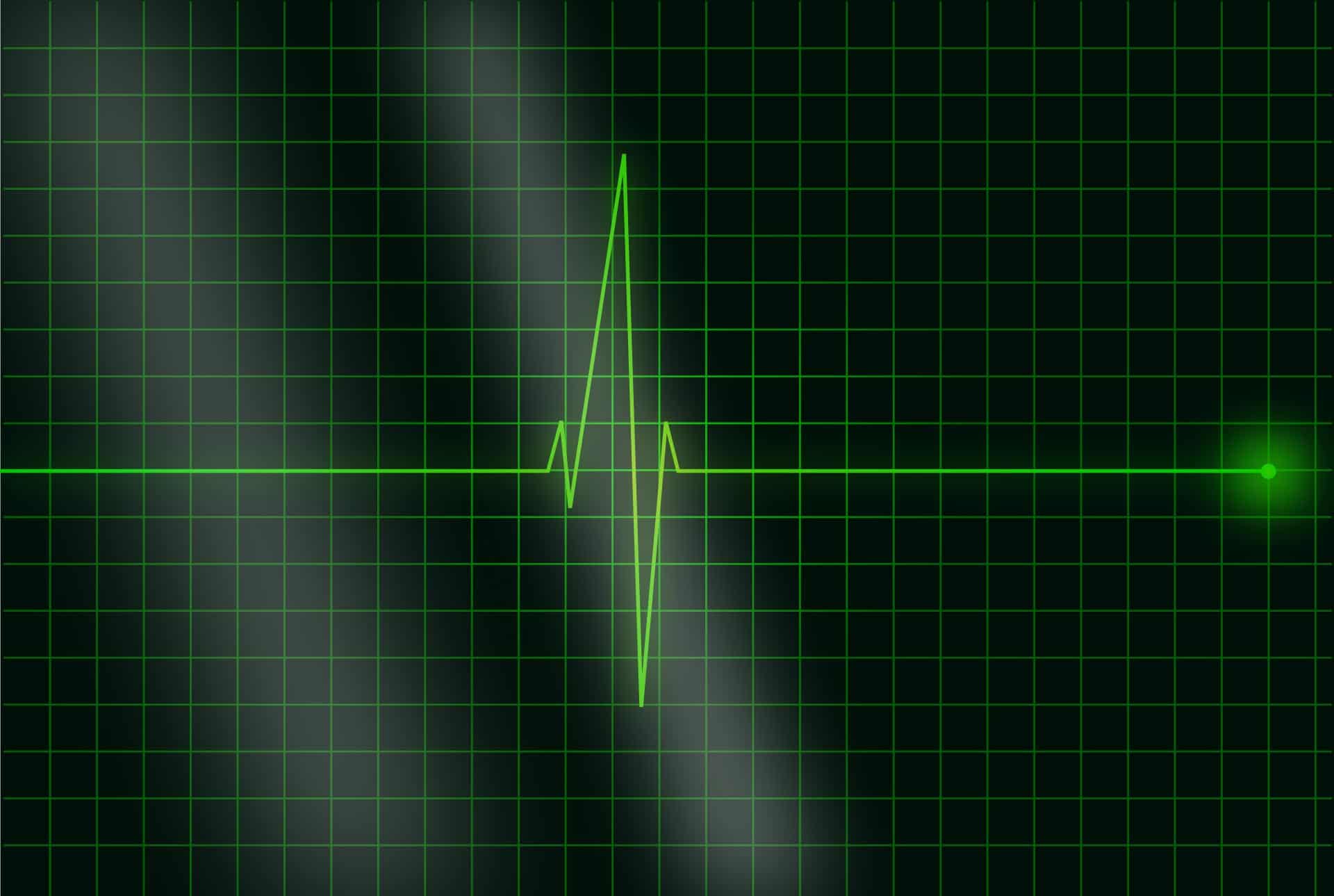 Your company needs a head and a heart